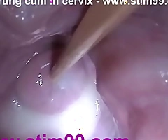 Outsert sperm jizz surrounding cervix nigh stretching cunt speculum